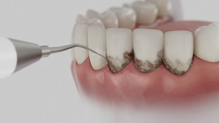 Reliable Emergency Dentist contractor in Elmhurst, IL by Smile Center Dentistry